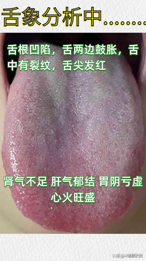 四不像正版资料2025和舌根和牙龈被缝一起与舌根和牙龈被缝一起怎么办