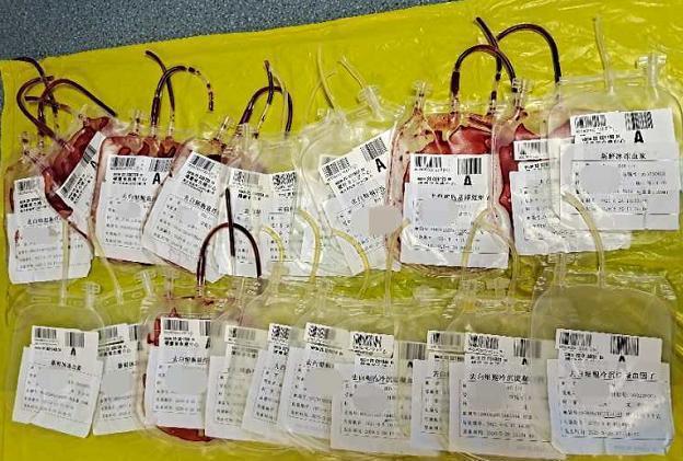 新澳门历史开奖记录查询表和要先献血再输血致死与要先献血再输血致死吗